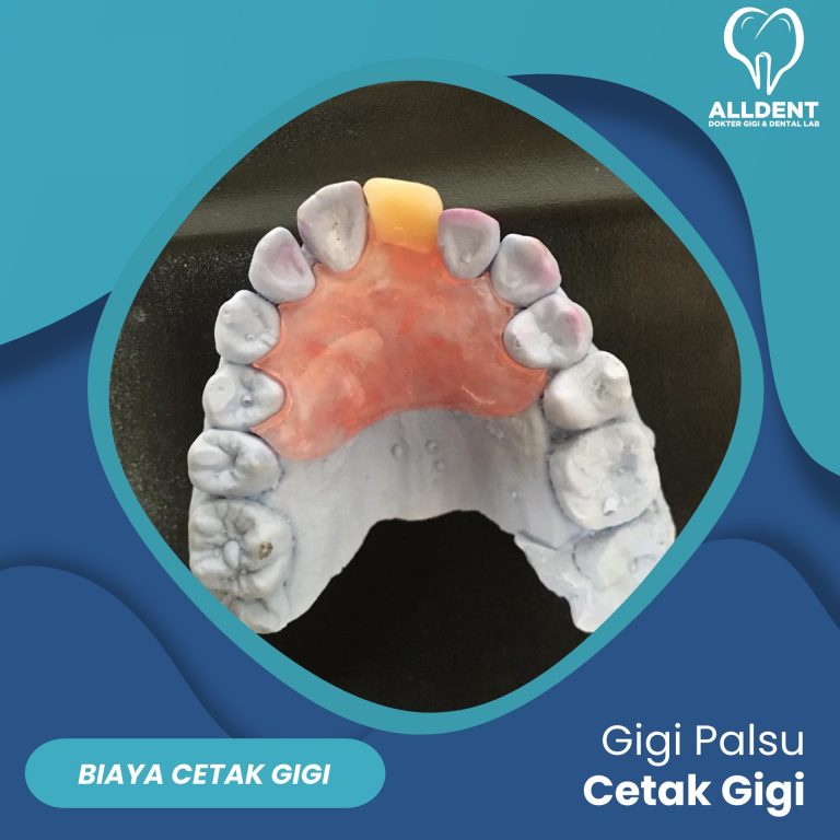 Cetakan Gigi Alginat