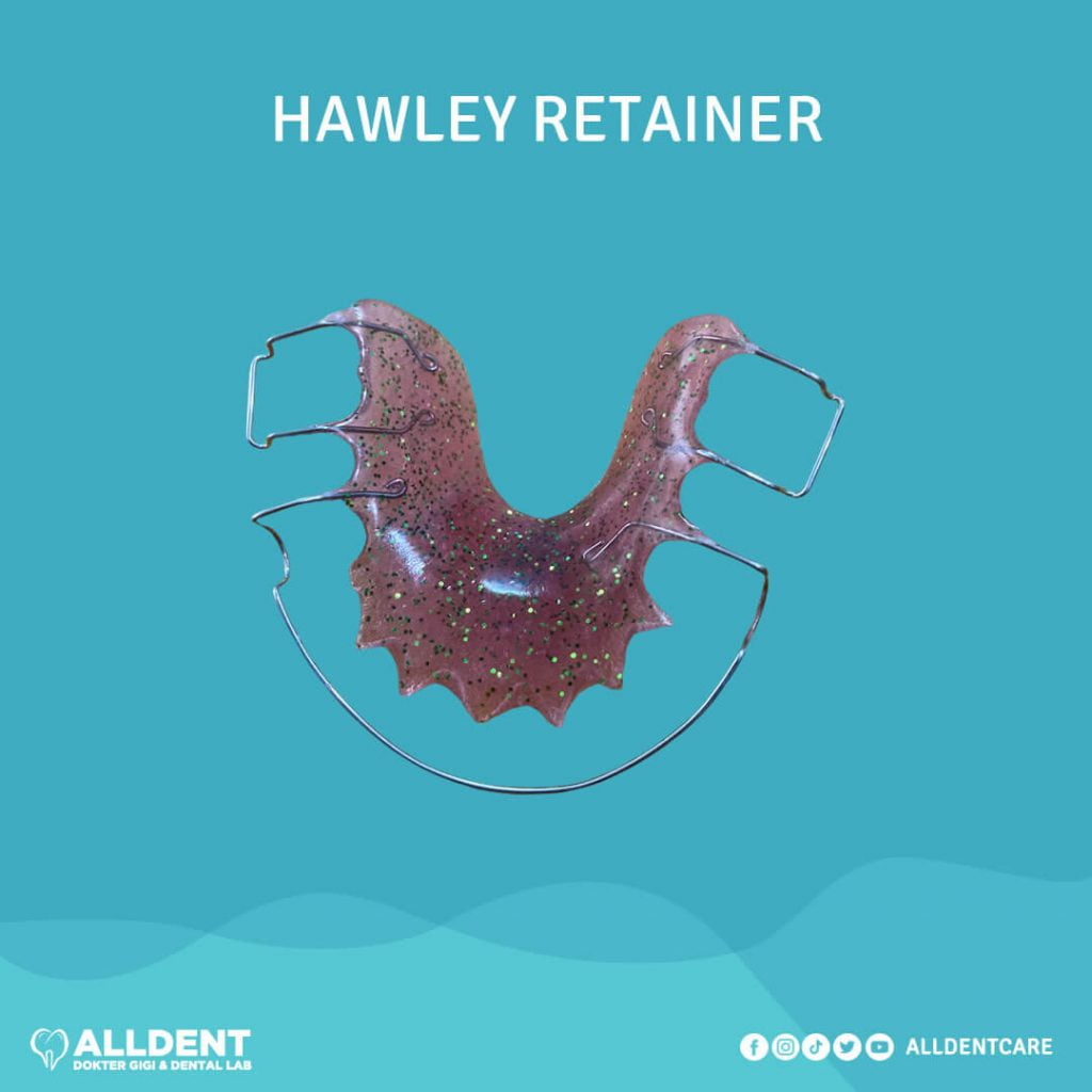 Promo Hawley Retainer