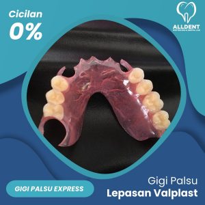 Express GigI Palsu Lepasan Valplast