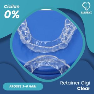 Retainer Gigi Clear