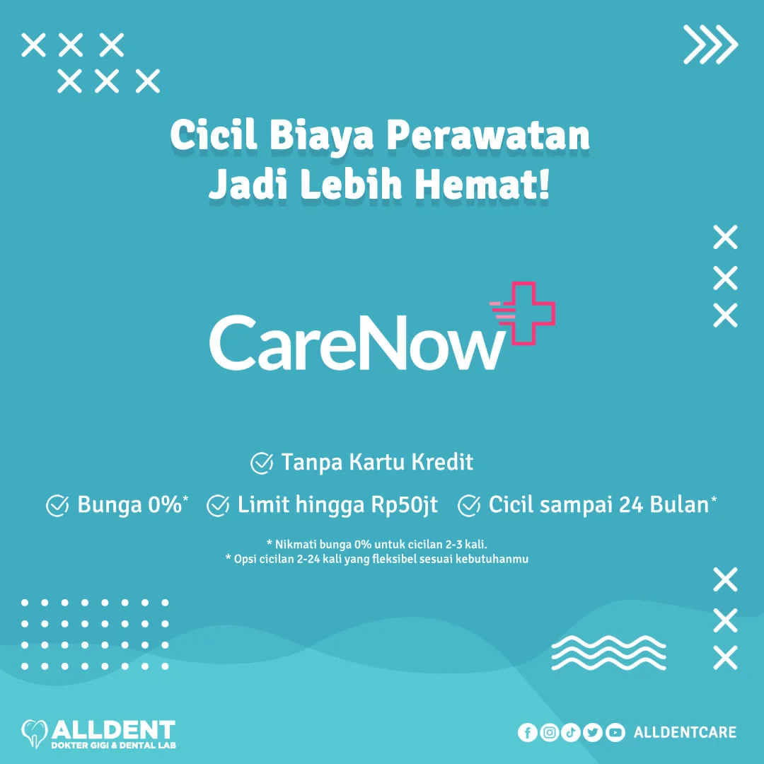 Installment of Dental Care Costs in Allden with Carenow