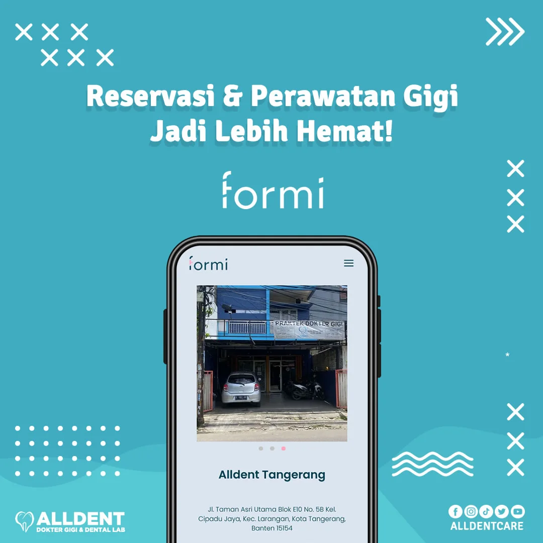 Perawatan Gigi di Alldent Bisa Reservasi dan Bayar Perawatan melalui Formi